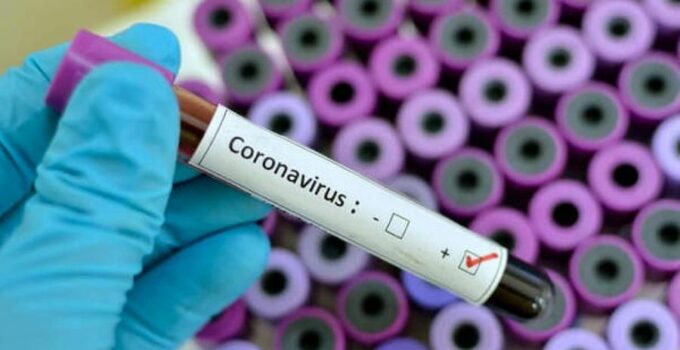 Coronavirus dati Sicilia